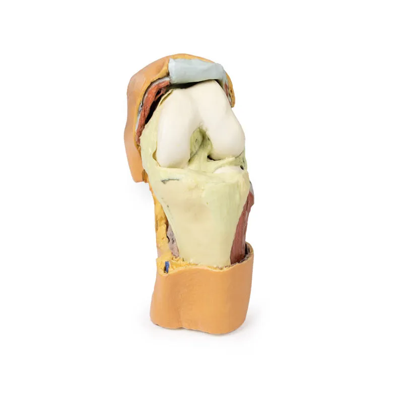 3D Printed Flexed knee joint deep dissection Model