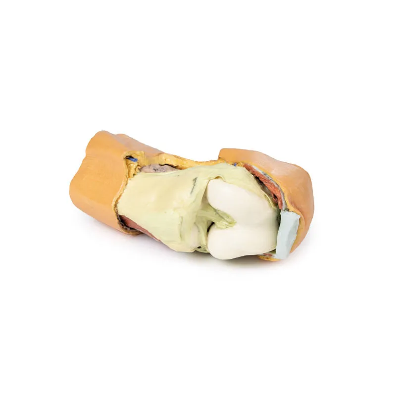 3D Printed Flexed knee joint deep dissection Model