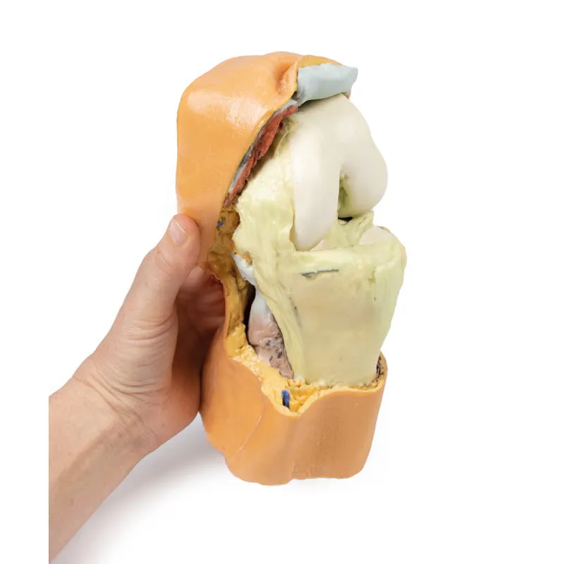 3D Printed Flexed knee joint deep dissection Model