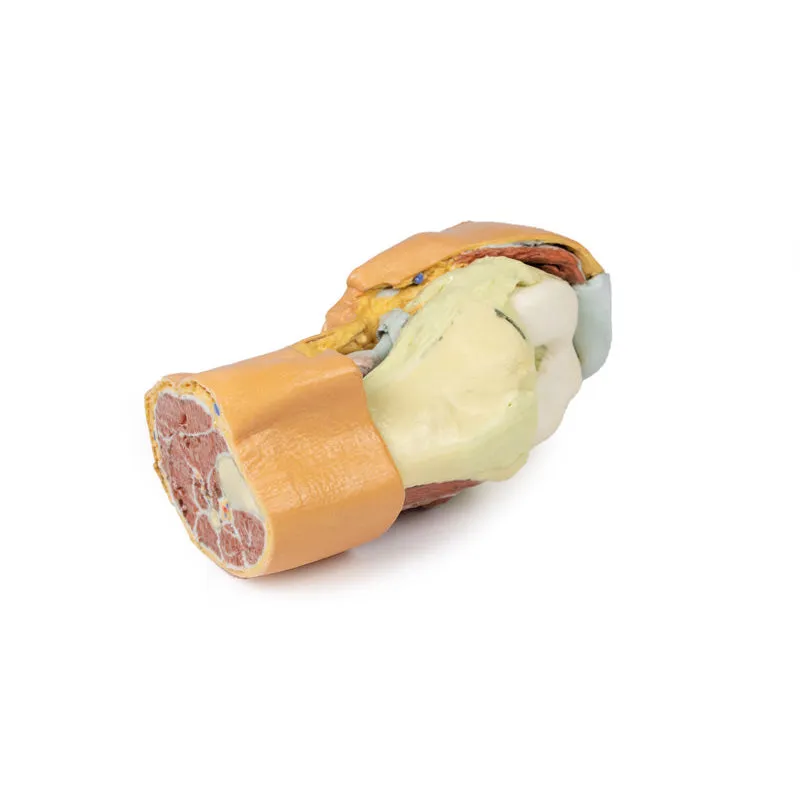 3D Printed Flexed knee joint deep dissection Model