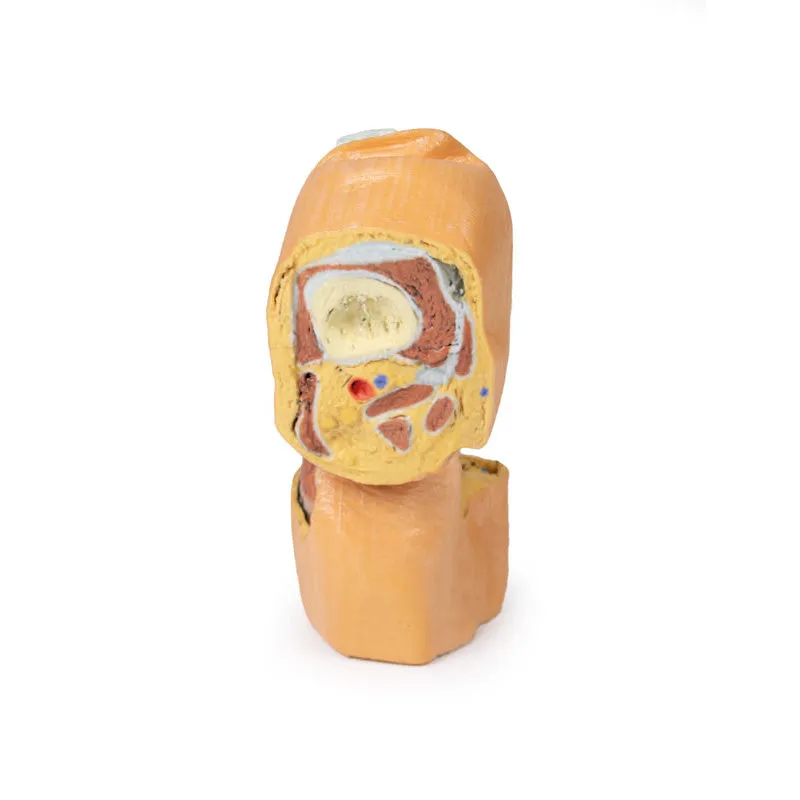 3D Printed Flexed knee joint deep dissection Model